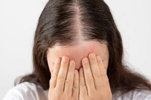 نازکی مو و ریزش آن!