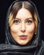 چهره زشت و عجیب فریبا نادری | فریبا نادری بیمار است؟