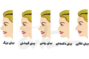 تست شخصیت شناسی | فرم بینی شما چگونه است؟ بینی عقابی دارید یا دکمه ای؟